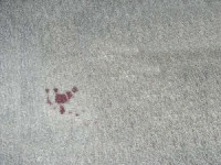 Tips For Removing Blood Stains from Carpet